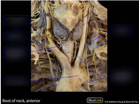 Diagram Of Root Of Neck Anterior Quizlet