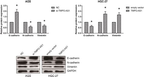 Tmpo As1 Activates Emt In Gc Cells The Expression Levels Of