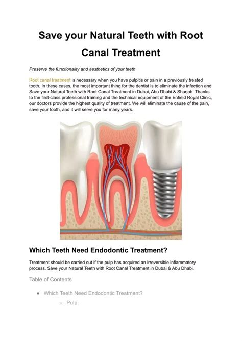 PPT Save Your Natural Teeth With Root Canal Treatment PowerPoint