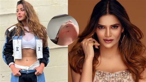 Khatron Ke Khiladi 13 Archana Gautam Cuts Chin Aishwarya Sharma Nyrra