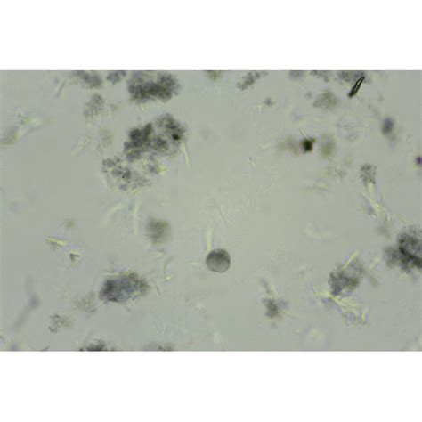 Entamoeba Histolytica Cysts Smear Medical And Science Media