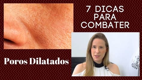 7 Dicas para Combater os POROS DILATADOS Dra Cínthia Orasmo