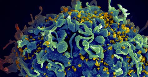 A Third Patient Is Now Reportedly Cured Of HIV