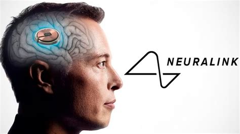 TelepatÍa El Primer Implante Neuralink En Ser Implantado En Un Humano Lenstv