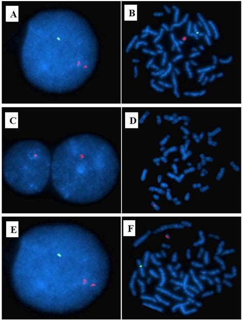 Interphase A And Metaphase B Fluorescence In Situ Hybridization