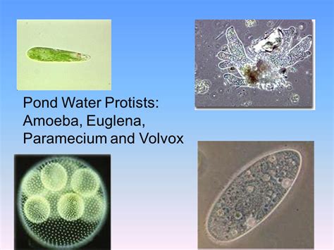 Protists Pond Water