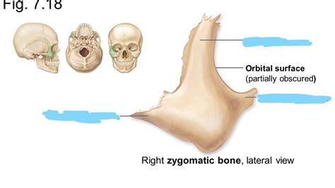 Zygomatic Bone Maxillary Process