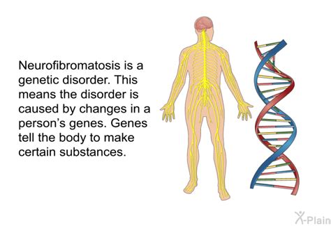 PatEdu.com : Neurofibromatosis