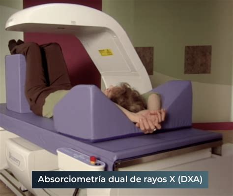 Sist De Densitometría ósea Hologic Discovery Dxa Medical Outfitters