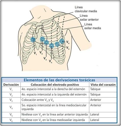 Colocación De Electrodos Med School Medicine Nurse