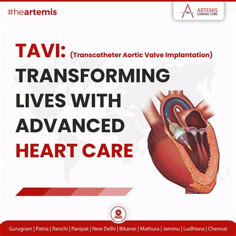 Revolutionizing Heart Care: Transcatheter Aortic Valve Implantation