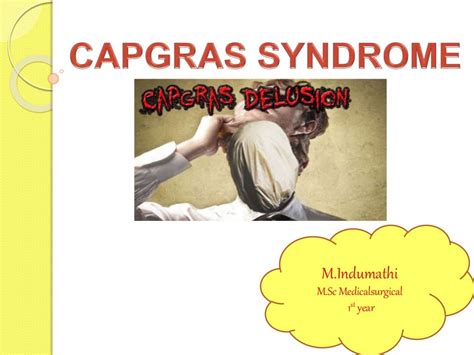 Capgras Syndrome