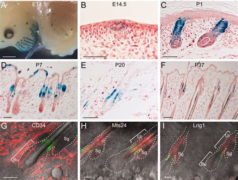 Lgr Marks Stem Cells In The Hair Follicle That Generate All Cell