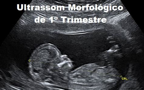 Ultrassonografia Pélvica Transvaginal Clinisomrad 55 3332 8724 55