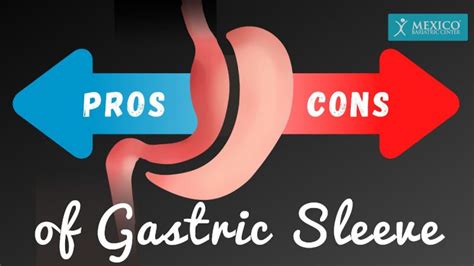 Pros And Cons Of Gastric Sleeve Surgery Is Vsg Right For Me