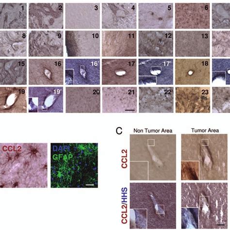 T cells express CCL2 receptor. Expression of CCR2 in T-cells in human... | Download Scientific ...