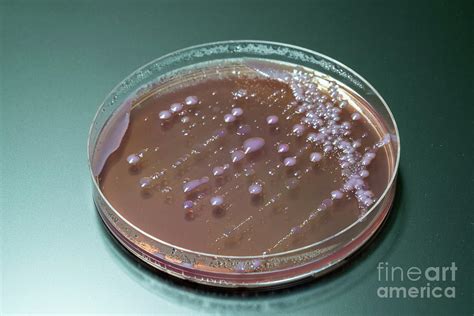 Bacterial Colonies On Agar Plate Photograph By Wladimir Bulgar Science