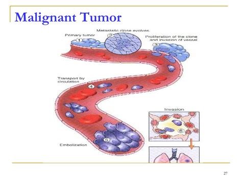 Ppt Neoplasia Powerpoint Presentation Free Download Id 4395044