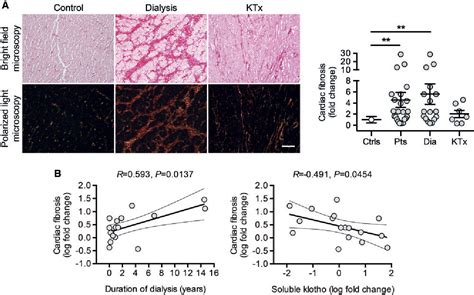 Figure 1 From Fibroblast Growth Factor 23 Is Induced By An Activated