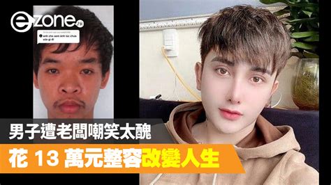 男子遭老闆嘲笑太醜 花 13 萬元整容改變人生 Ezone