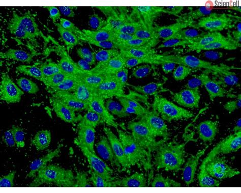 Human Dermal Microvascular Endothelial Cells Hdmec