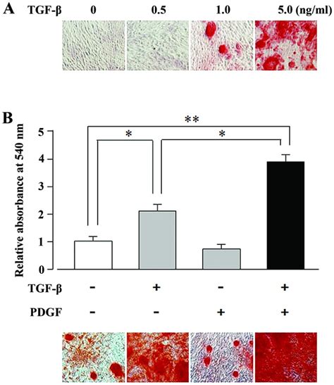 Platelet-derived growth factor (PDGF) markedly enhanced the ...