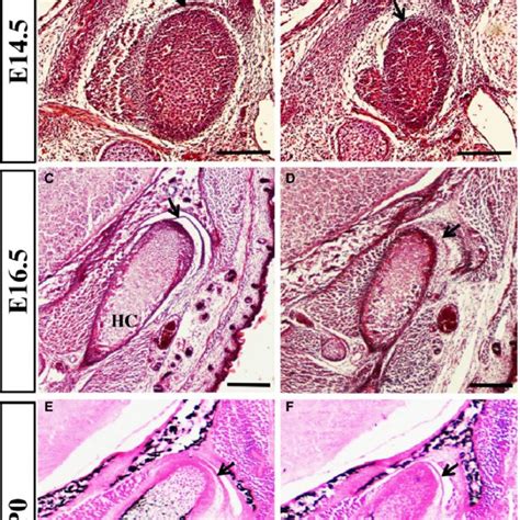 Craniofacial Morphology Of Wnt1 Cre Fam20b Flox Flox Mice The Gross