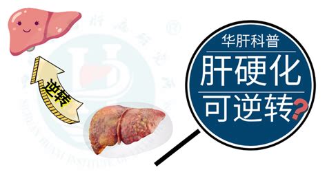 得了“肝硬化”，就不能实现逆转了吗？ 知乎