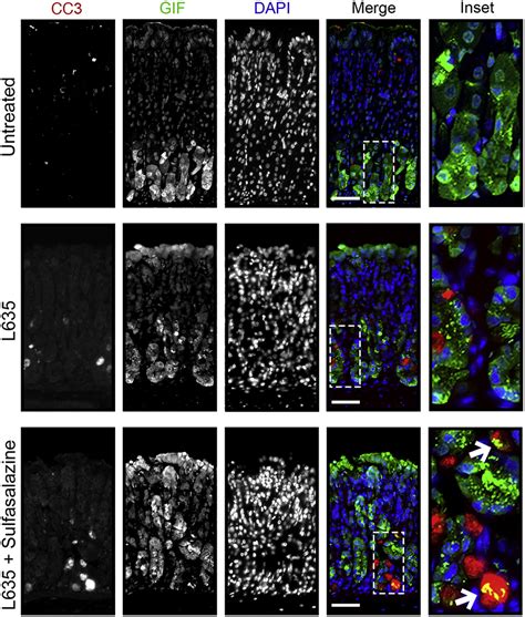 Cystine Glutamate Antiporter XCT Is Required For Chief Cell