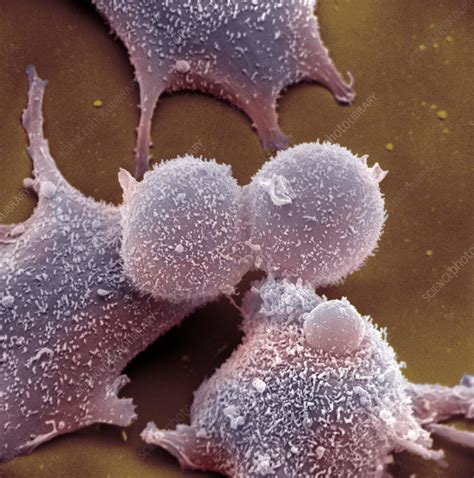 human fibroblast cells stock image  science photo library