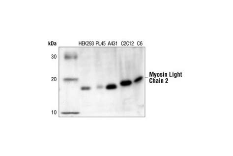 Myosin Light Chain 2 Antibody | Cell Signaling Technology