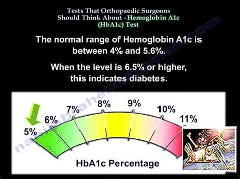 Hemoglobin a1c normal range - blocklua