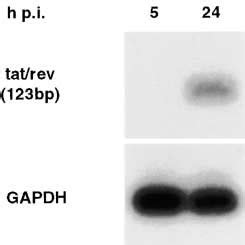 Irf Mrna Is Induced Early Upon Hiv Infection And Before Expression