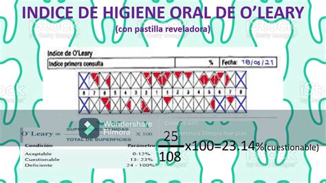 Índice de Higiene Oral IHO O leary con pastilla reveladora YouTube