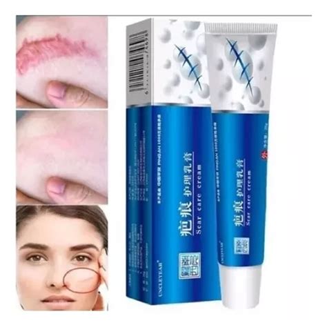 Pomada Que Tira Cicatriz - Pomada Tira Remove Cicatriz Queloide Espinhas | Frete grátis