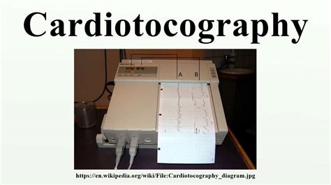 Cardiotocography - YouTube