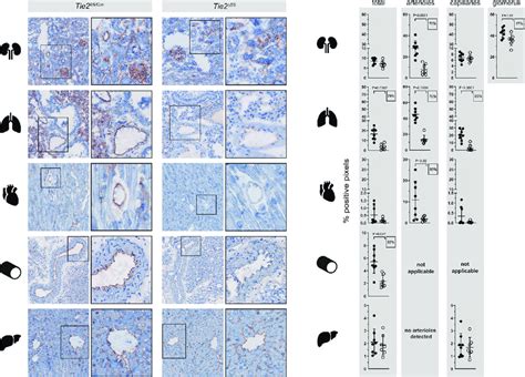 expression patterns  tie protein  organs  control  tie