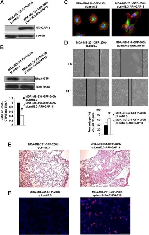 Arhgap18 Downregulation By Mir 200b Suppresses Metastasis Of Triple