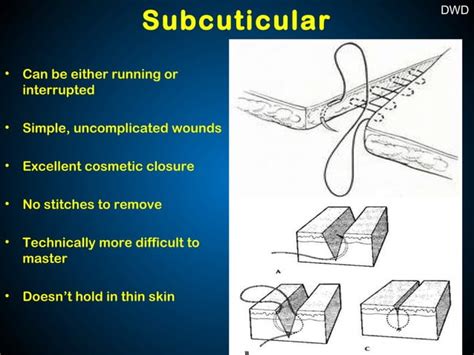 Surgical Sutures and Suturing Techniques