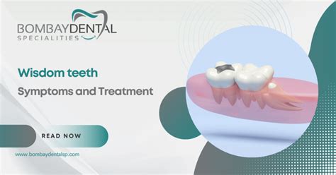 Wisdom Tooth Symptoms and Treatment | Bombay Dental Specialities