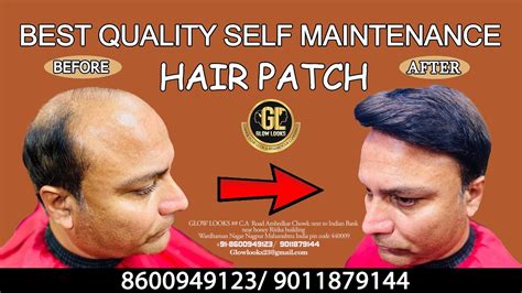 Best Quality Hair Patch Hair Patch In Nagpur Hair Bonding In Nagpur Call 9011879144 Youtube