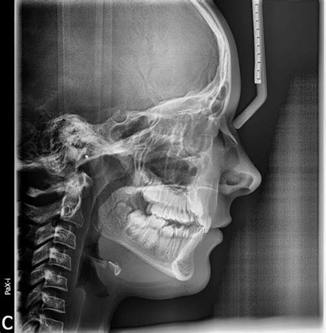 ECOMED RTG Stomatologiczne Diagnostyka Radiologiczna