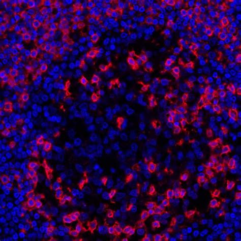 CD45RO Monoclonal Antibody (UCHL-1) (A500-020A)