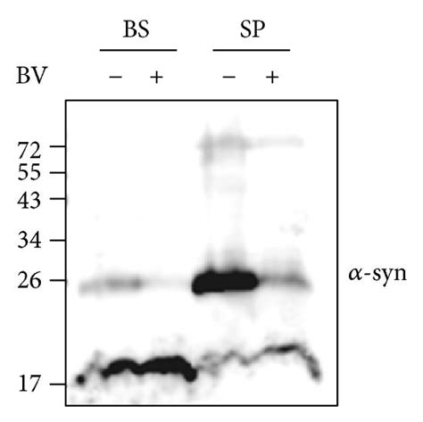 Western Blotting Analysis Of Synuclein Expression Levels In The