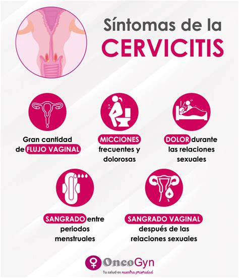O Que E Cervicite Cronica - O Que Cervicite Crônica - BRAINCP