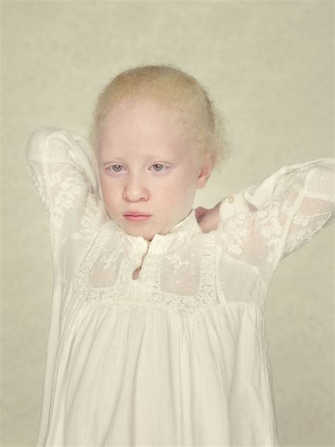 Альбиносы в объективе Густаво Ласерде » BigPicture.ru