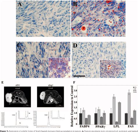 Tumorigenesis And Neoplastic Progression Soluble Forms Of The Notch