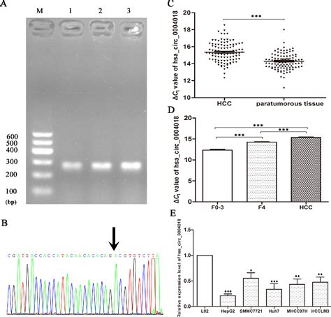 Figure 1 From Screening Differential Circular RNA Expression Profiles