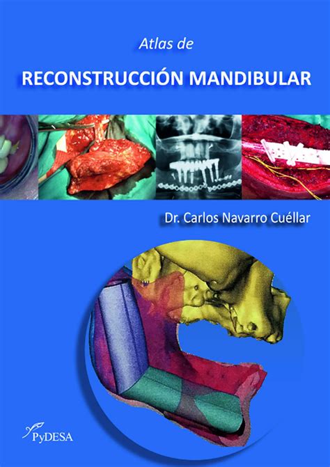 Atlas De Reconstrucci N Mandibular En Laleo