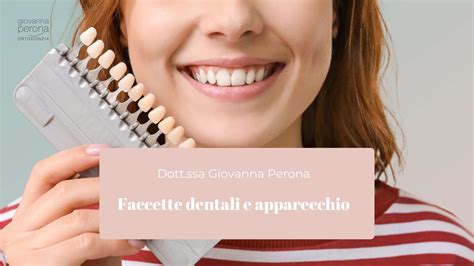 Faccette Dentali E Apparecchio Usi E Differenze